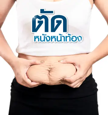 ตัดหนังหน้าท้อง