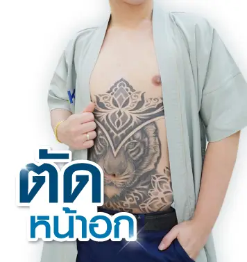 ผ่าตัดลดขนาดหน้าอก